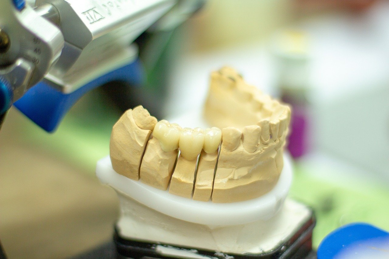 dentures, dentist, healthcare, dentistry, smile, ceramic, instruct, handwork, person, clinic, equipment, healthy, articulator, dentist, dentist, dentist, dentistry, dentistry, dentistry, dentistry, dentistry