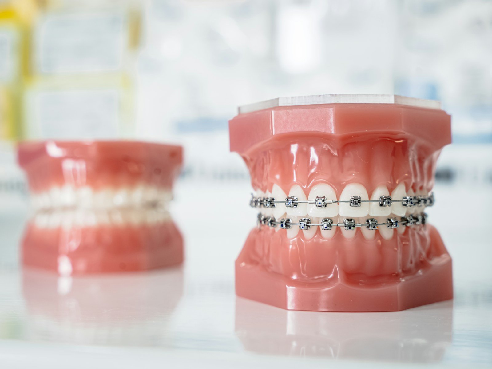 dentista maspalomas experto